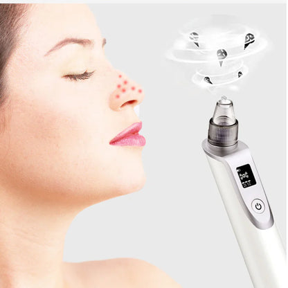 Ultrasonic Pore Cleanser Blackhead Remover