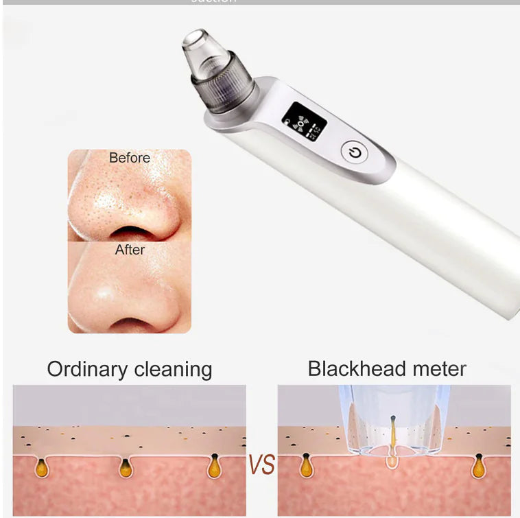Ultrasonic Pore Cleanser Blackhead Remover